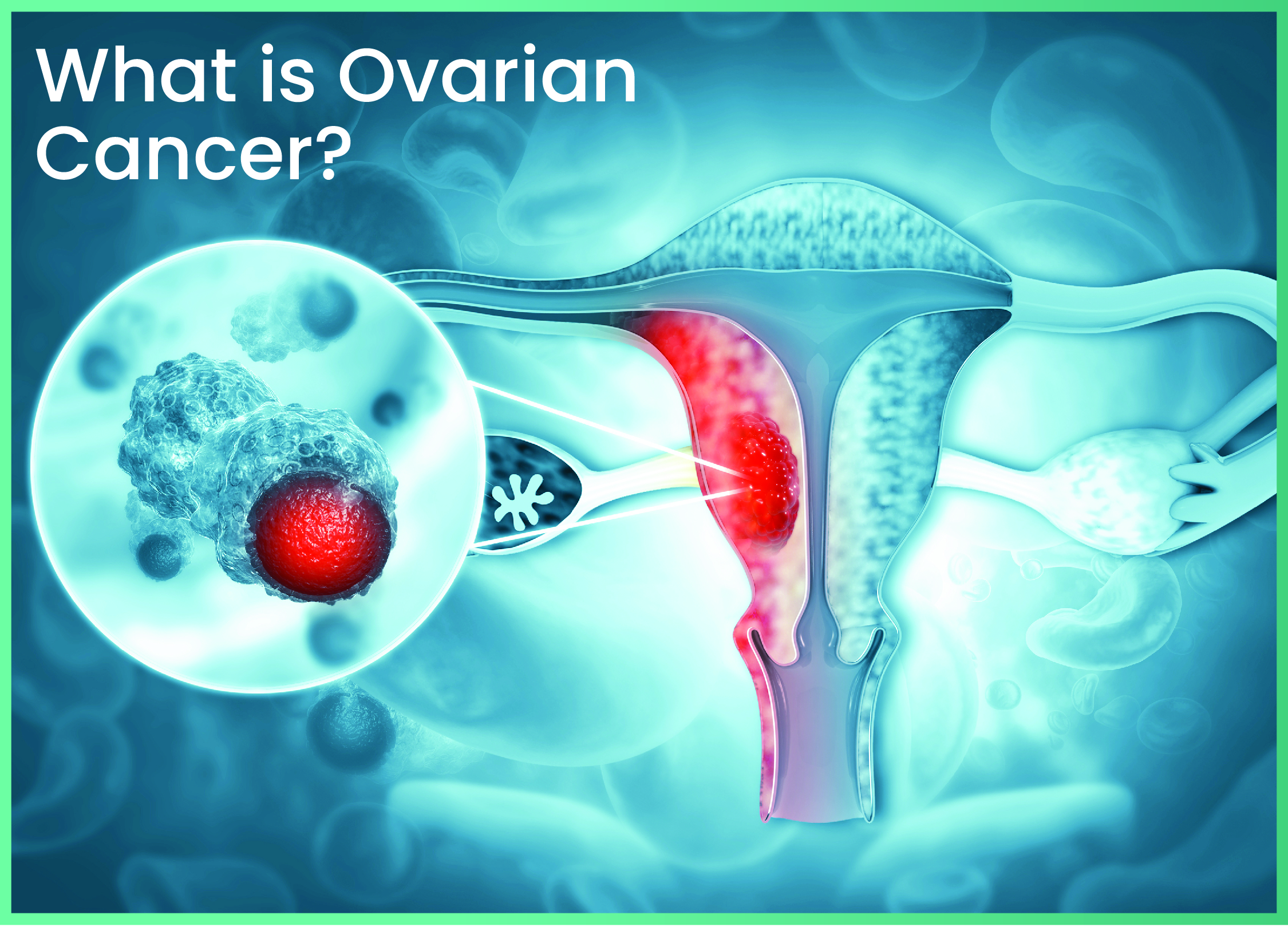 Cervical Cancer