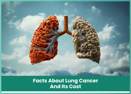 Lung Cancer Treatment Cost & Facts | Dr. Reetu Jain