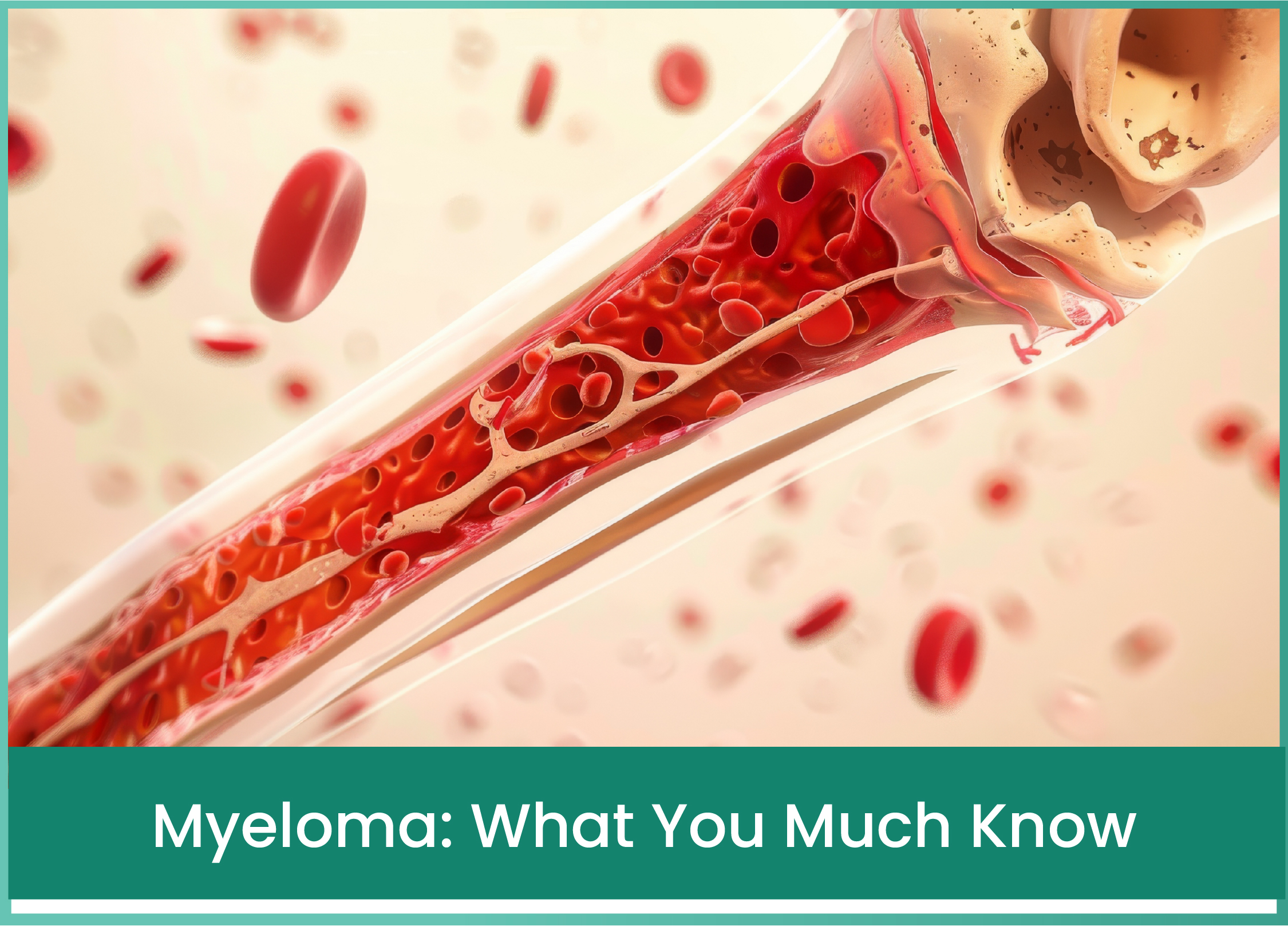Multiple Myeloma: Symptoms & Treatment | Dr. Reetu Jain